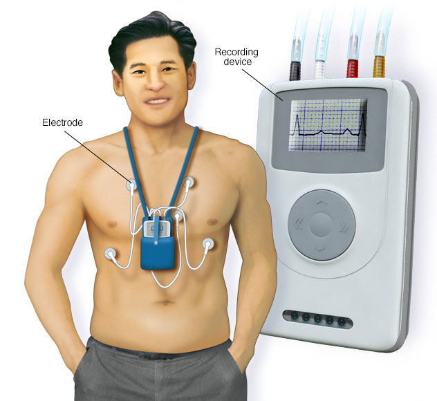 HỆ THỐNG HOLTER ĐIỆN TIM